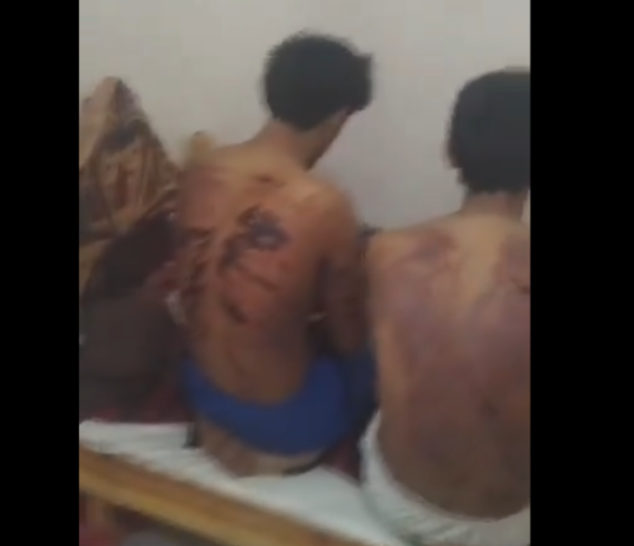 تعذيب 7 شباب يمنيين من قبل الجيش العماني بطريقة وحشية