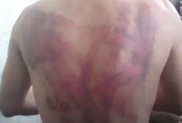 صحفي يمني يحكي ما تعرض له أثناء اعتقاله