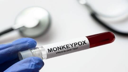 من يحتاج إلى التطعيم ضد جدري القردة؟