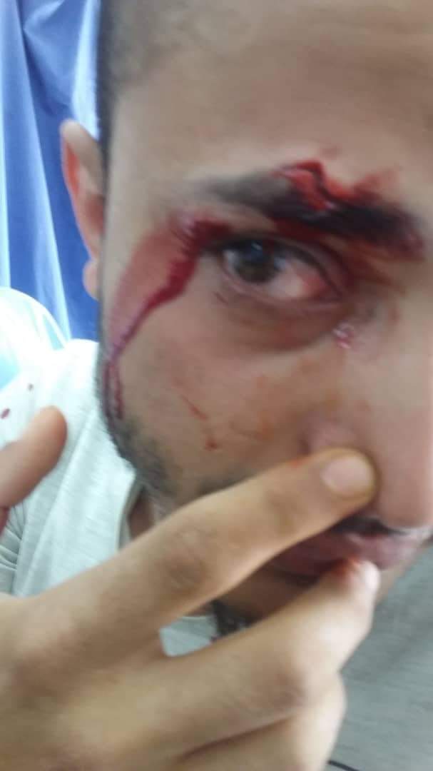 مسلح يوجه ضربة قوية بمؤخرة السلاح الذي يحمله.. بوجه طالب يتجهز لحفل التخرج