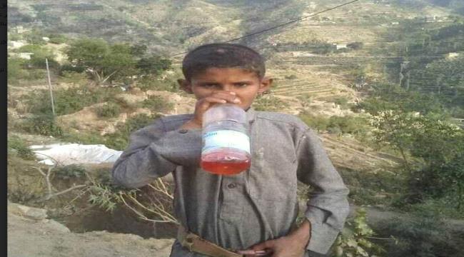 ربما تعد الأولى من نوعها.. طفل يمني يعيش على رائحة البترول