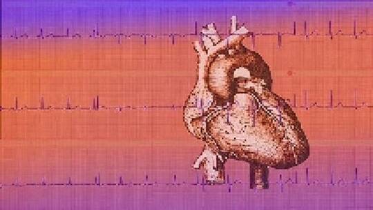 مرض يمكن الخلط بينه وبين تشوهات القلب