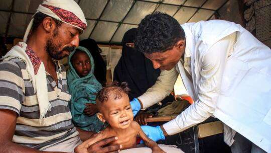 منظمة : الأطفال اليمنيون ما زالوا يموتون من الجوع