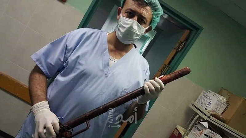 طبيب ماهر ينقذ شاب من الموت.. بعد دخول حديدة قطرها 5 سم في صدره