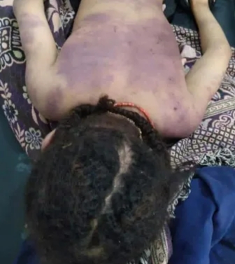 جريمة مروعة أم يمنية تضرب طفلتها حتى الموت