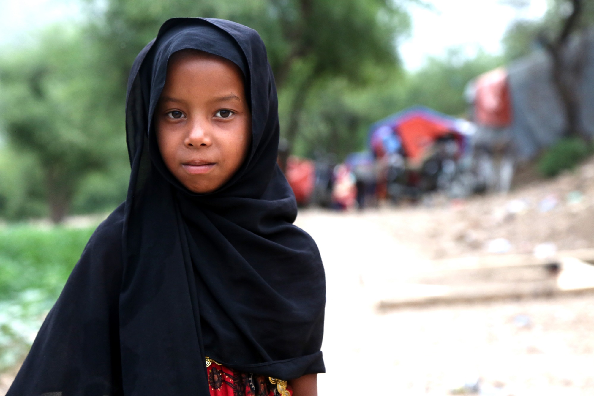 طفلة يمنية تعاني من الجوع